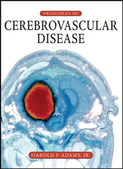 Principles of Cerebrovascular Disease, Hardback Book