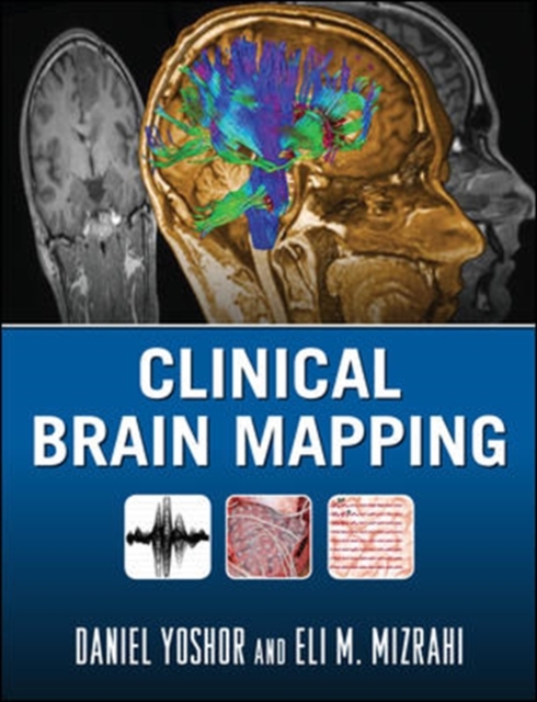 Clinical Brain Mapping, Hardback Book