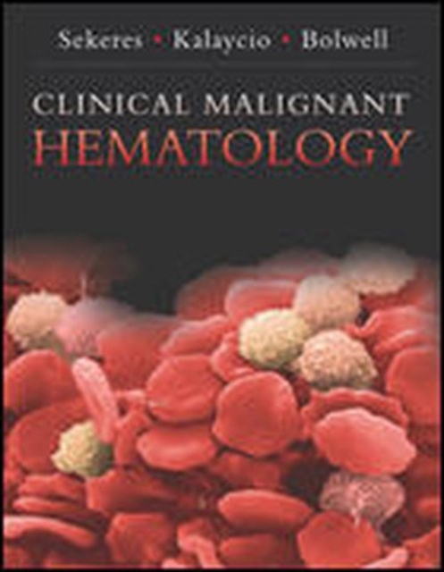 Clinical Malignant Hematology, EPUB eBook