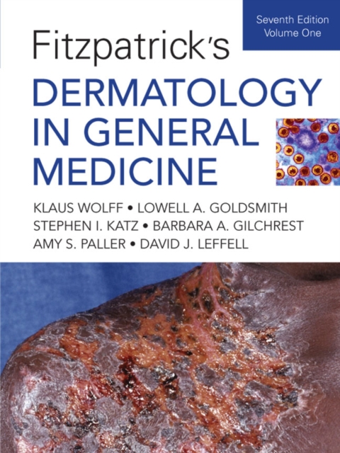 Fitzpatrick's Dermatology In General Medicine, Seventh Edition : Two Volumes, PDF eBook