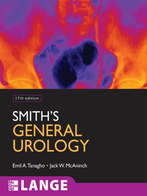 Smith's General Urology, Seventeenth Edition, EPUB eBook