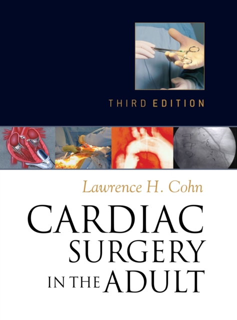 Cardiac Surgery in the Adult, Third Edition, EPUB eBook