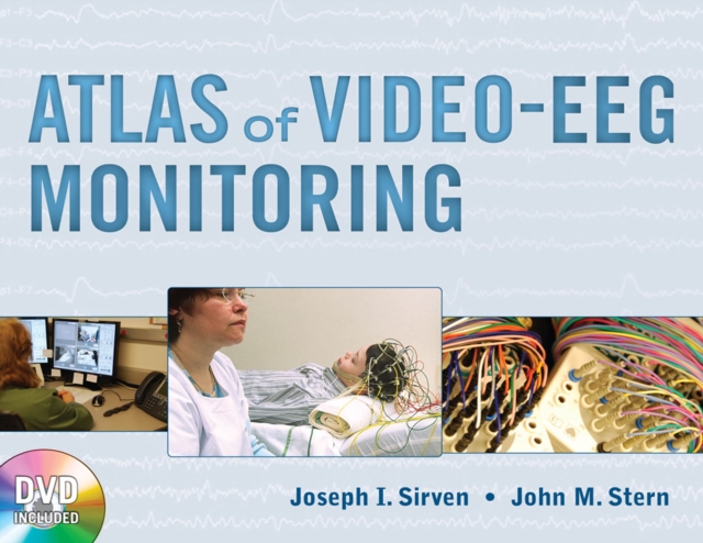 Atlas of Video-EEG Monitoring, EPUB eBook