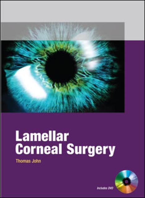 Lamellar Corneal Surgery,  Book