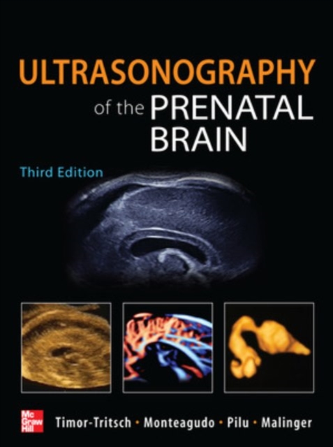Ultrasonography of the Prenatal Brain, Third Edition, Hardback Book