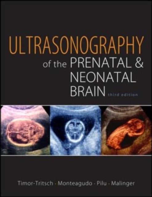 Ultrasonography of the Prenatal Brain, Third Edition, EPUB eBook