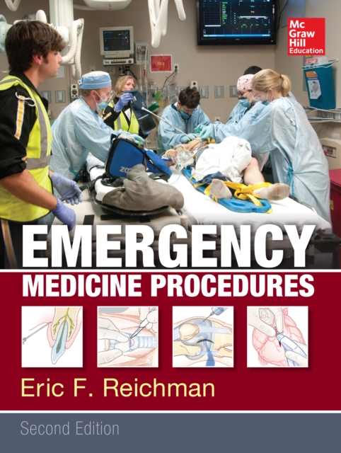 Emergency Medicine Procedures, Second Edition, EPUB eBook