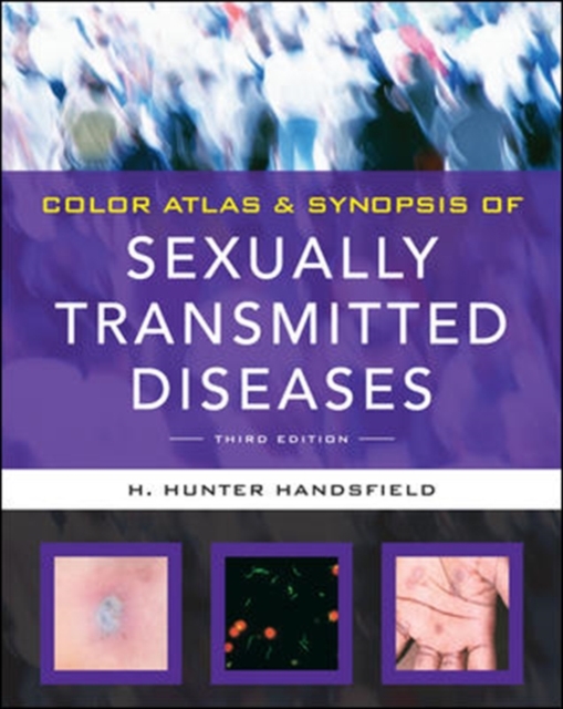 Color Atlas & Synopsis of Sexually Transmitted Diseases, Third Edition, Paperback / softback Book