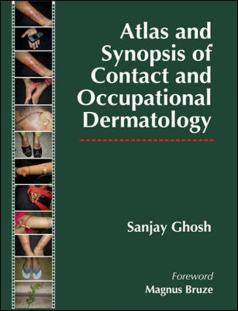 Atlas and Synopsis of Contact and Occupational Dermatology, Hardback Book