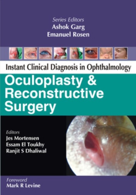 Oculoplasty and Reconstructive Surgery, Paperback / softback Book