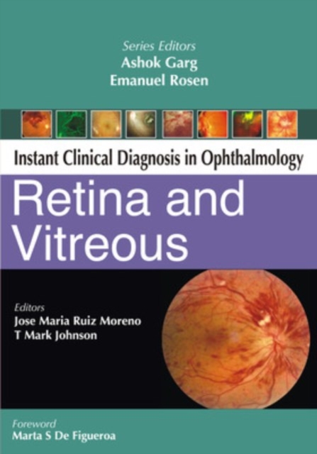 Retina and Vitreous, Paperback / softback Book