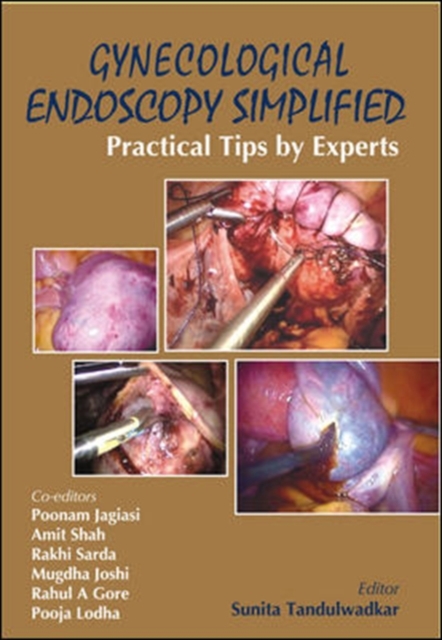 Gynecological Endoscopy Simplified: Practical Tips by Experts, Paperback Book