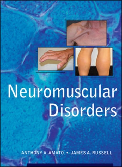 Neuromuscular Disorders, EPUB eBook