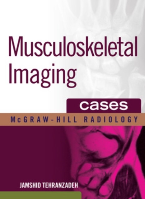Musculoskeletal Imaging Cases, EPUB eBook