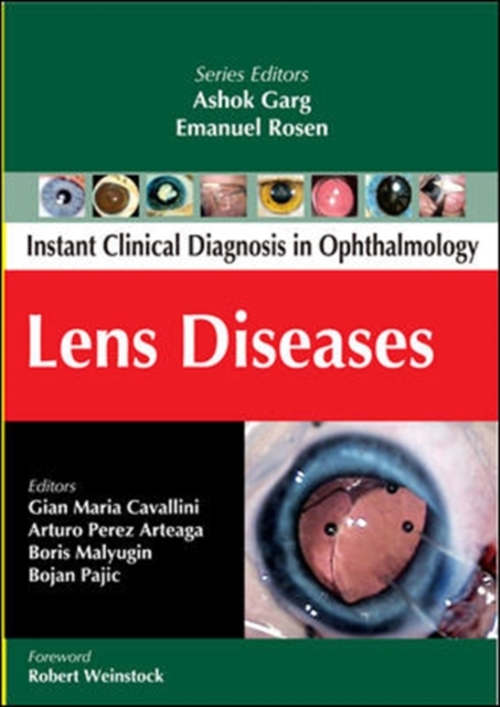 Lens Diseases, Paperback / softback Book