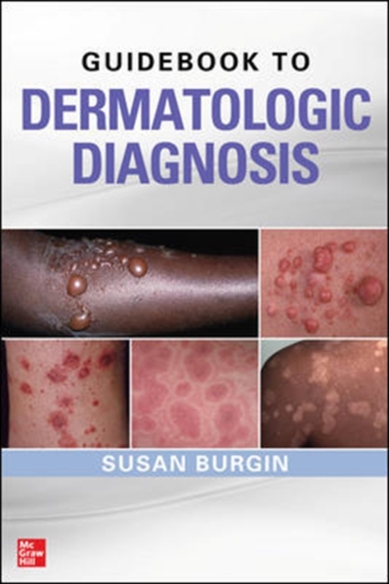 Guidebook to Dermatologic Diagnosis, Paperback / softback Book