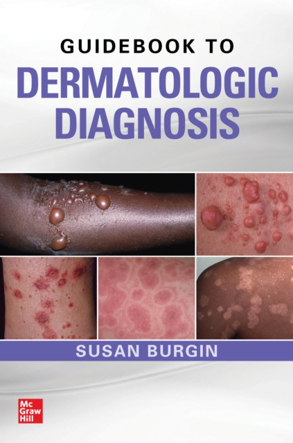 Guidebook to Dermatologic Diagnosis, EPUB eBook