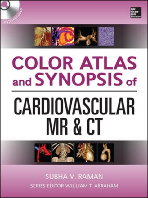 Color Atlas and Synopsis of Cardiovascular MR and CT (SET 2), Book Book