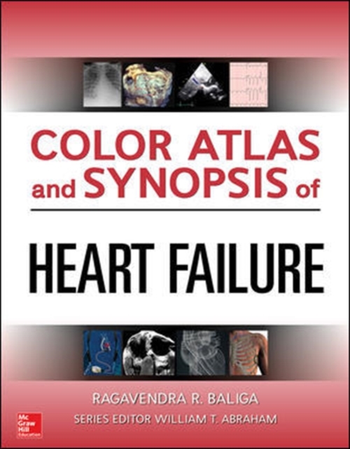 Color Atlas and Synopsis of Heart Failure, Hardback Book