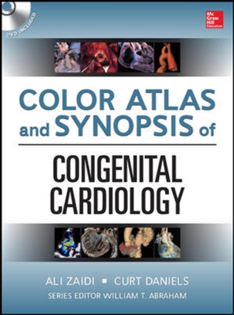Color Atlas and Synopsis of Adult Congenital Heart Disease,  Book