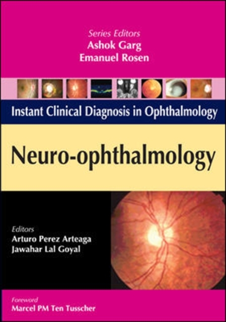 Neuro-Ophthalmology,  Book