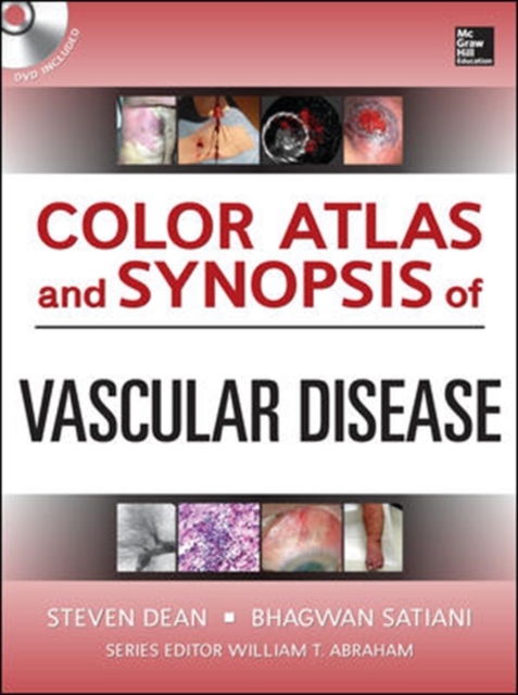 Color Atlas and Synopsis of Vascular Disease, Book Book
