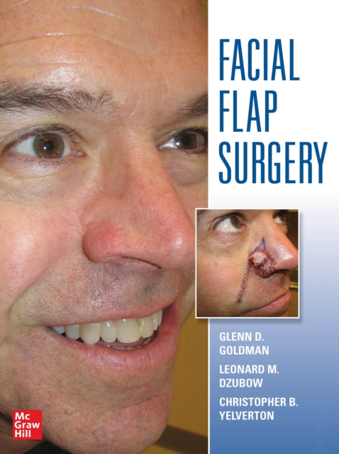 Facial Flaps Surgery, EPUB eBook