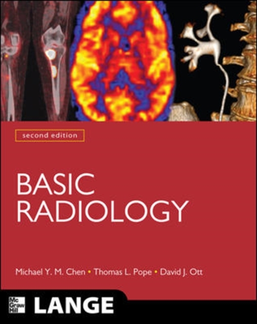 Basic Radiology, Second Edition, EPUB eBook