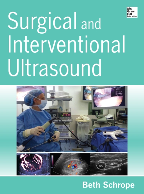 Surgical and Interventional Ultrasound, EPUB eBook
