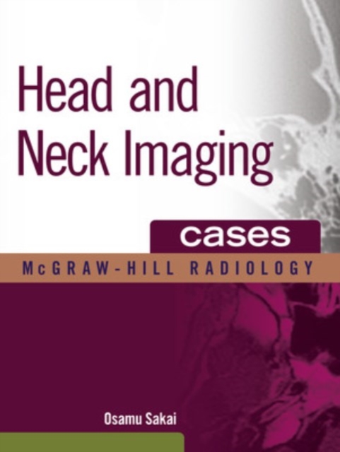 Head and Neck Imaging Cases, EPUB eBook