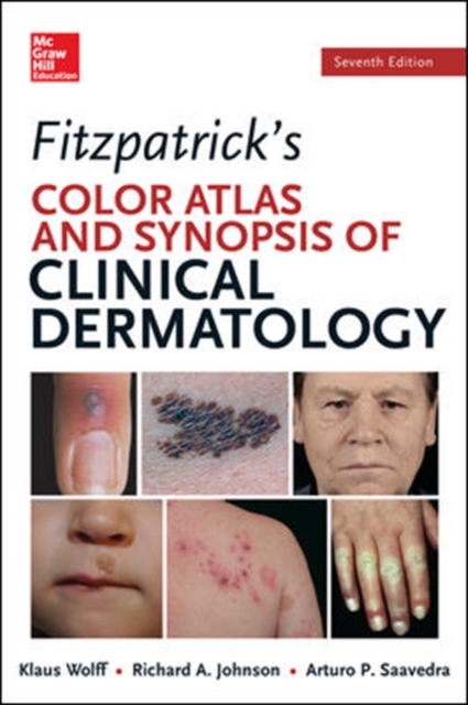 Fitzpatricks Color Atlas and Synopsis of Clinical Dermatology, Paperback Book