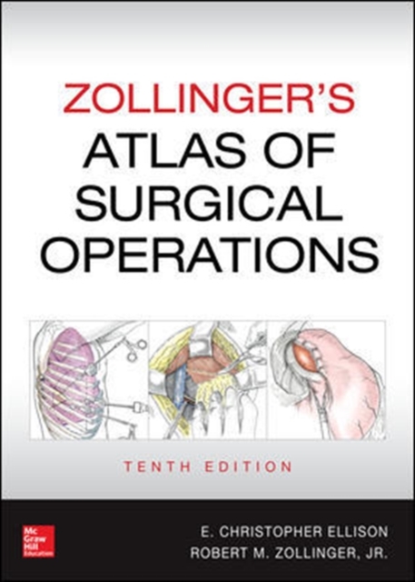 Zollinger's Atlas of Surgical Operations, Tenth Edition, Hardback Book