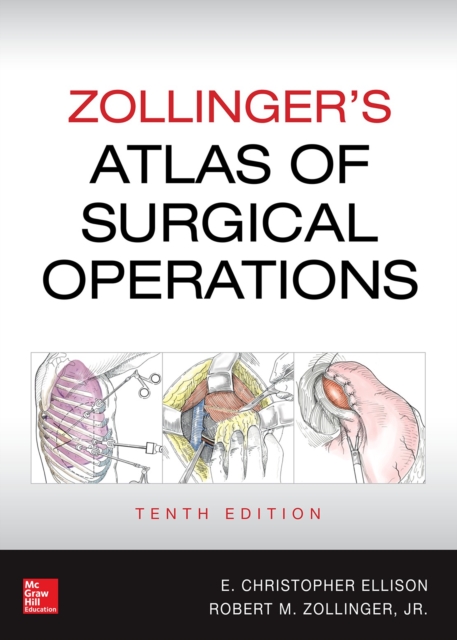 Zollinger's Atlas of Surgical Operations, 10th edition, EPUB eBook