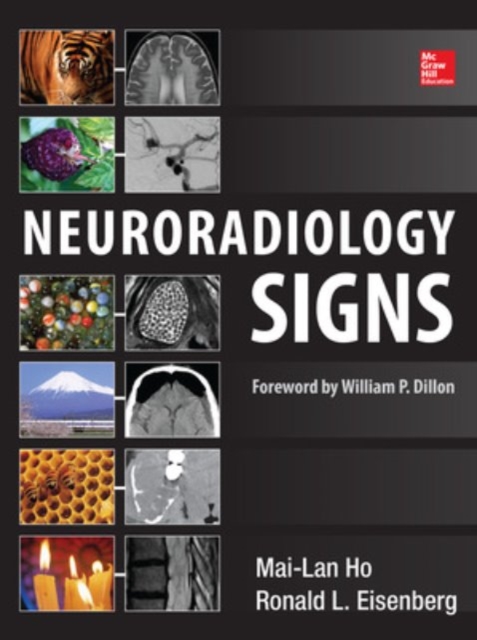 Neuroradiology Signs, Hardback Book