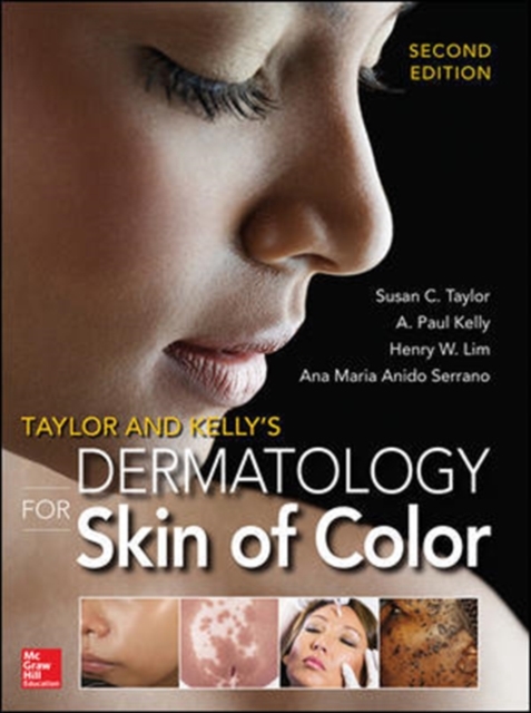 Taylor and Kelly's Dermatology for Skin of Color 2/E, Hardback Book