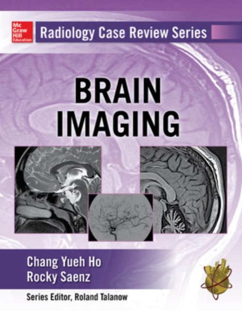 Radiology Case Review Series: Brain Imaging, Paperback / softback Book