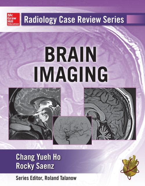 Radiology Case Review Series: Brain Imaging, EPUB eBook