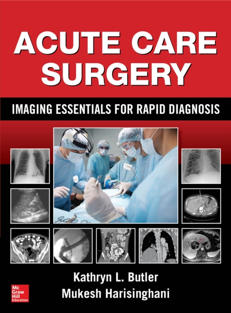 Acute Care Surgery: Imaging Essentials for Rapid Diagnosis, EPUB eBook