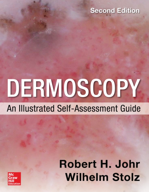 Dermoscopy: An Illustrated Self-Assessment Guide, EPUB eBook