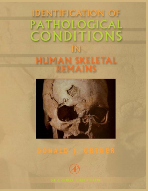 Identification of Pathological Conditions in Human Skeletal Remains, EPUB eBook
