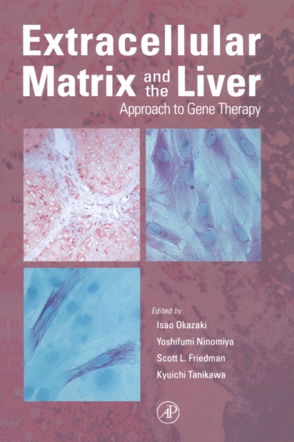 Extracellular Matrix and The Liver : Approach to Gene Therapy, PDF eBook