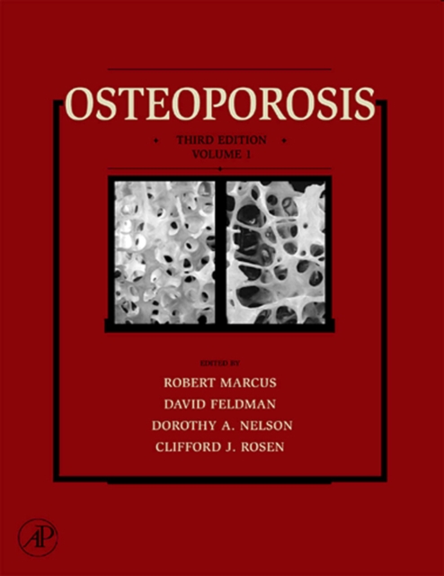 Osteoporosis, EPUB eBook