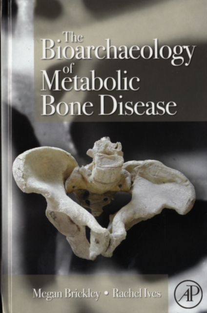 The Bioarchaeology of Metabolic Bone Disease, PDF eBook