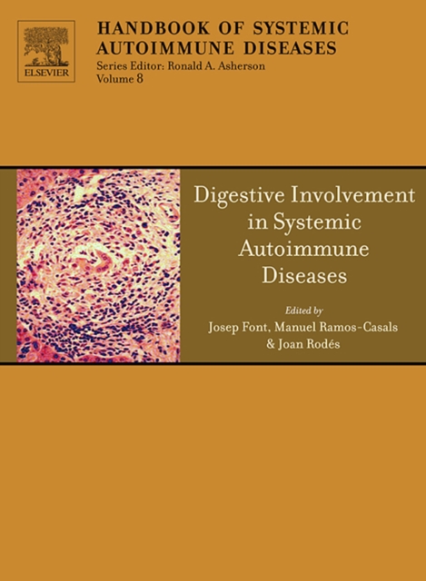 Digestive Involvement in Systemic Autoimmune Diseases, PDF eBook