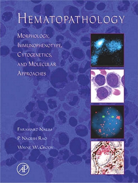 Hematopathology : Morphology, Immunophenotype, Cytogenetics, and Molecular Approaches, EPUB eBook