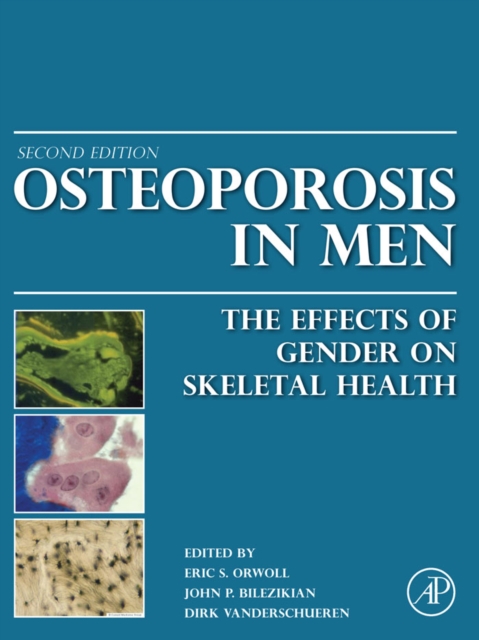 Osteoporosis in Men : The Effects of Gender on Skeletal Health, EPUB eBook