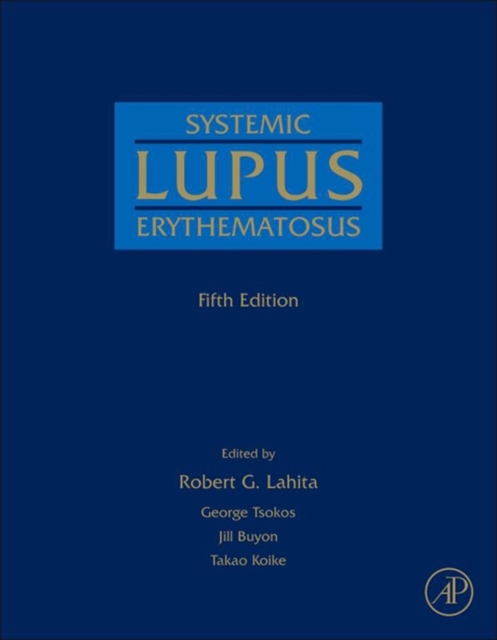 Systemic Lupus Erythematosus, EPUB eBook