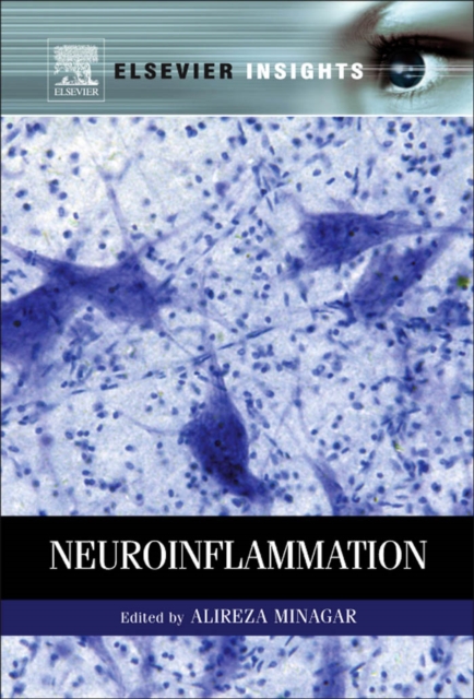 Neuroinflammation, PDF eBook