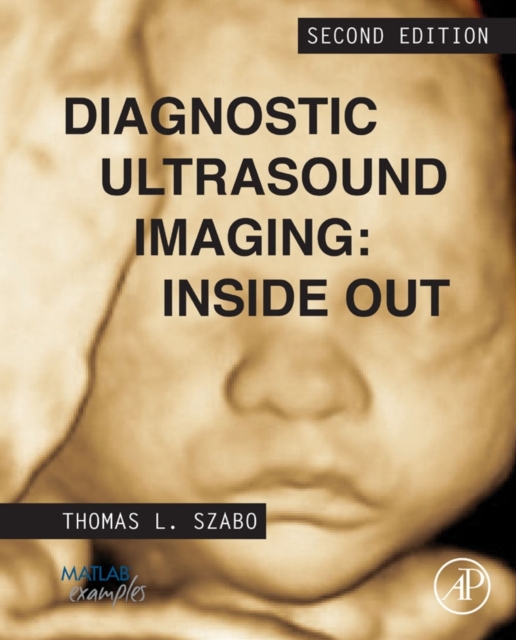 Diagnostic Ultrasound Imaging: Inside Out, Hardback Book