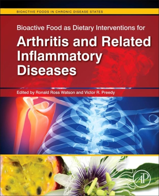 Bioactive Food as Dietary Interventions for Arthritis and Related Inflammatory Diseases : Bioactive Food in Chronic Disease States, EPUB eBook